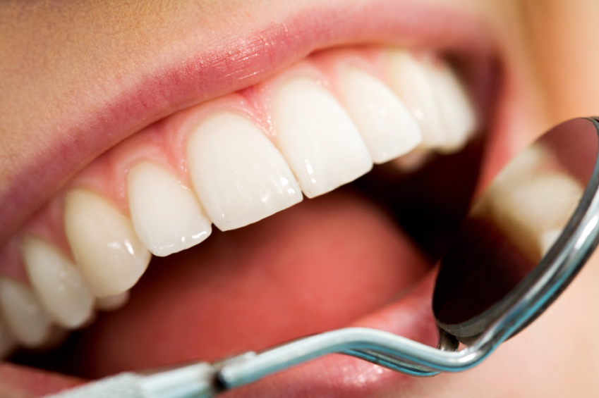 iStock_000009248063Small