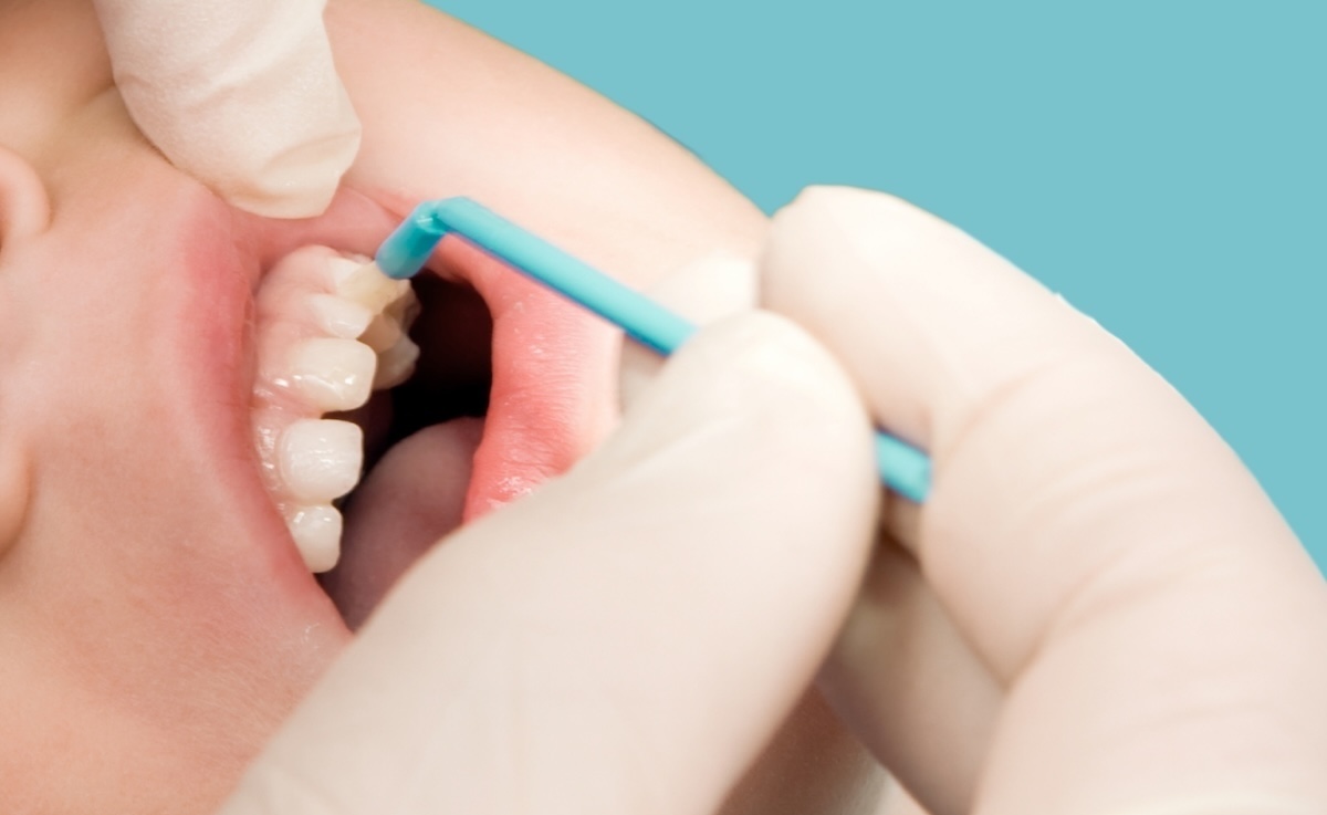 Accredited Certificate in Fluoride Varnish Application and Certificate in Plaque Indices