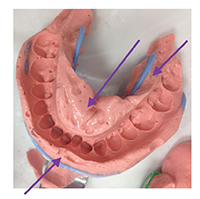 alginate4b