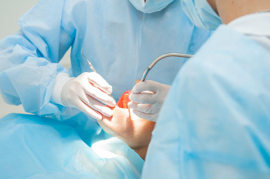 dental implant nursing