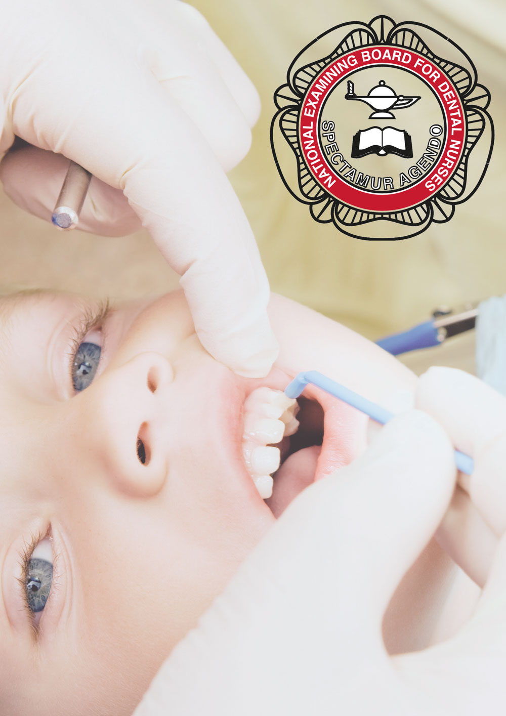 nebdn fluoride varnish application