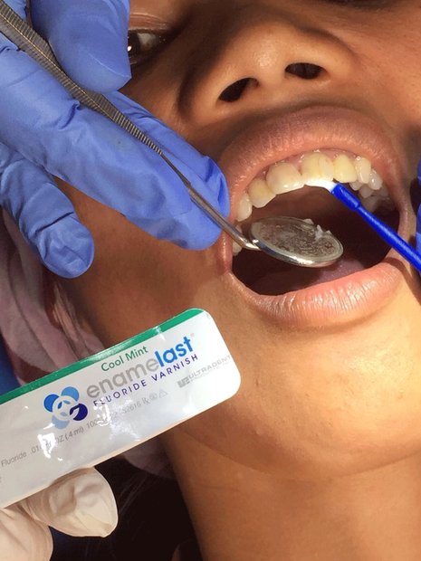 Optident donation helps to protect Cambodian children’s teeth
