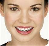 Orthodontic Nursing – what to expect