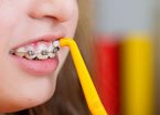 Diary of an Orthodontic Nurse - Oral Health