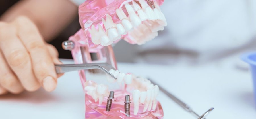 Is Implant Nursing for You