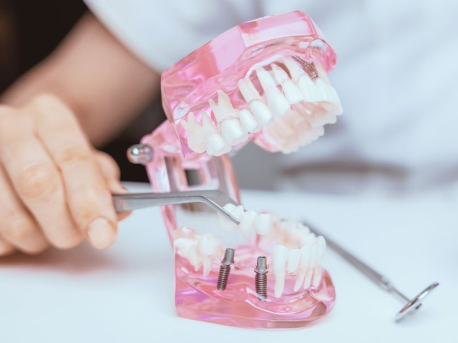 Is Implant Nursing for You